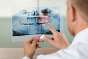 Endodoncia