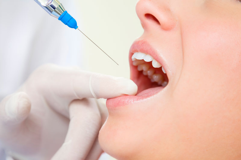 Clínica Dental Willson en Vigo tratamientos endodoncia