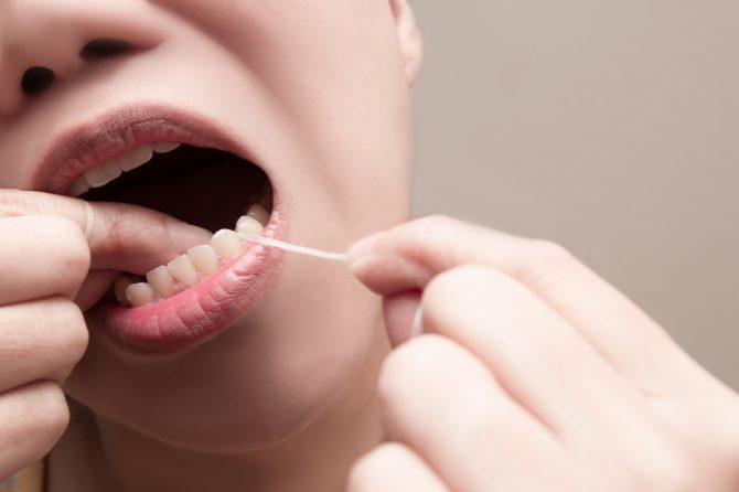 La gingivitis y su tratamiento