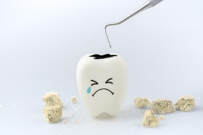 Síntomas de la caries dental