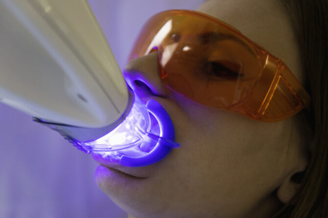 Alimentos que afectan tu blanqueamiento dental