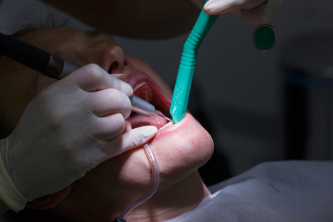Detección temprana de la enfermedad periodontal y su importancia